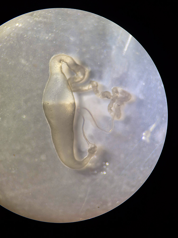 an ampulla shaped gland under a microscope